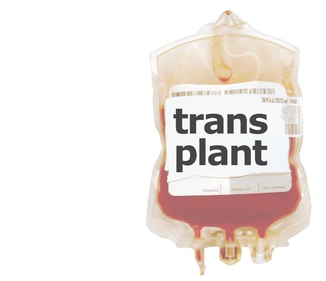 transplant