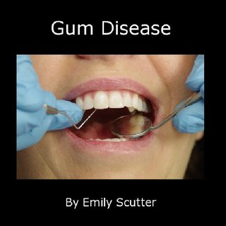 Gum Disease